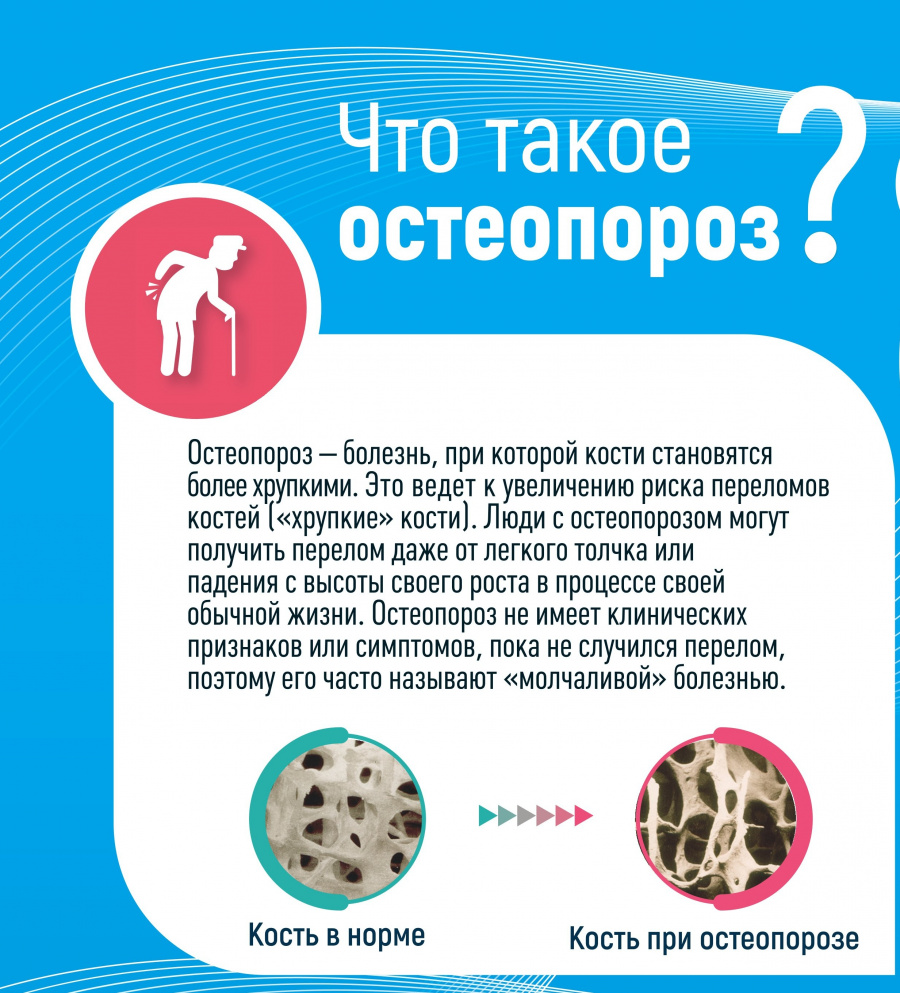 Что такое остеопороз?